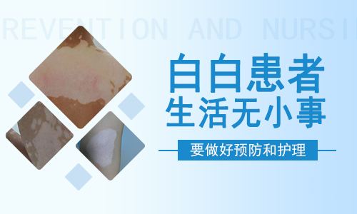 白癜风的正确护理方法有什么