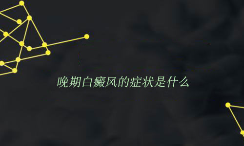 晚期白癜风的症状是什么